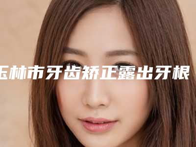 玉林市牙齿矫正露出牙根医院排行榜前十强预测(玉林口腔病防治所解锁前五名~)