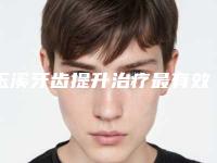 玉溪牙齿提升治疗最有效的方法是什么