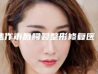 焦作市唇腭裂整形修复医生排名最强（张凤香医生实力技术远超同行）