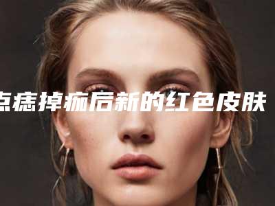 点痣掉痂后新的红色皮肤怎么保养点痣后脱痂了是红色的