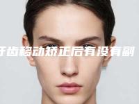 牙齿移动矫正后有没有副作用呢