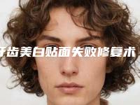 牙齿美白贴面失败修复术有哪些适宜人群