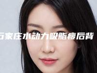 石家庄水动力吸脂瘦后背整形医院排名前十