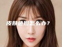 皮肤色斑怎么办？