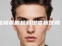 盐城市眼睑裂斑症状医院排名清单收好-盐城维多利亚医疗美容整形医院