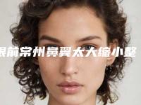 眼前常州鼻翼太大缩小整形医院综合实力前十口碑排行满城风靡&常州兰陵医院整形美容中心整形价格表_项目费用明细