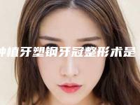 种植牙塑钢牙冠整形术是否安全
