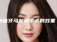 种植牙马龙桥手术的效果与优点有哪些