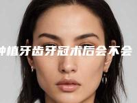 种植牙齿牙冠术后会不会有后遗症
