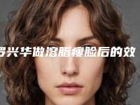 罗兴华做溶脂瘦脸后的效果是怎么样的呢