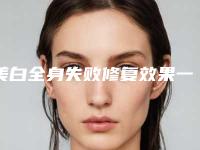 美白全身失败修复效果一般维持多久-美白全身三大治疗效果是什么