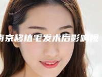 南京移植毛发术后影响视力吗