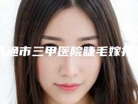 南通市三甲医院睫毛嫁接种睫毛医院(南通大学附属医院整形外科注重正规和技术)