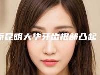 原昆明大华牙齿根部凸起治疗术后护理措施和优势
