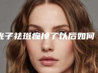 光子祛斑痂掉了以后如何保养皮肤c8祛斑效果怎么样