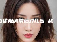 假体隆胸前后对比图 终于可以“抬头挺胸”了