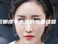 双眼皮手术后的恢复过程及注意事项须知(双眼皮手术术后恢复注意事项)