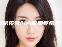 双眼皮微创内眼角疙瘩怎么办 让夏天美得更炫丽