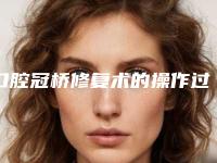 口腔冠桥修复术的操作过程及术后护理