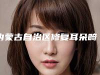 内蒙古自治区修复耳朵畸形费用-内蒙古自治区修复耳朵畸形价格都很贵吗