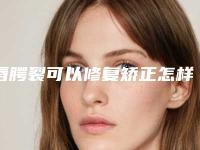 唇腭裂可以修复矫正怎样做好术后护理
