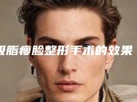 吸脂瘦脸整形手术的效果真的好