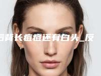 后背长痘痘还有白头_反复长痘痘什么原因