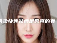 吕梁快速祛痘是否真的有效果「吕梁快速祛痘效果可以管多久」