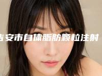 吉安市自体脂肪颗粒注射丰颞医生排行榜前十佳新榜单发布-李雄医生家家实力超群