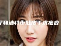 呼和浩特市肚皮手术疤痕去除医生哪位做得好-陈华主任医师整形医生谁收费便宜