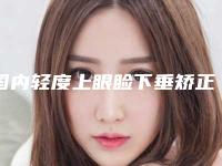国内轻度上眼睑下垂矫正医院推荐:轻度上眼睑下垂矫正医院TOP50今日亮相