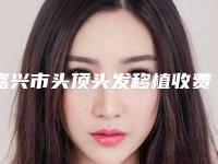 嘉兴市头顶头发移植收费价格查询-嘉兴市头顶头发移植价格行情