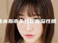 佳木斯市永红区脂溢性脱发植发排名前十整形机构名单分享!佳木斯市永红区脂溢性脱发植发精品医疗机构