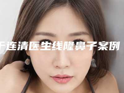 于连清医生线隆鼻子案例-价位表内部流出