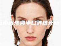 云南省瑞典半口种植牙新版项目价格表爆出-云南省瑞典半口种植牙价格
