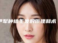 伊犁种植毛发的原理和术后护理