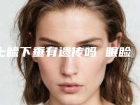 上睑下垂有遗传吗 眼睑下垂的病因(上眼睑下垂遗传的几率有多少)