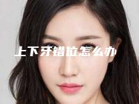 上下牙错位怎么办