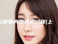 上颌窦内提升术过程(上颌窦外提升术注意事项)