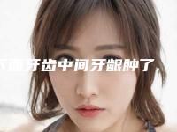 下面牙齿中间牙龈肿了,怎么判断牙缝是蛀牙还是牙石