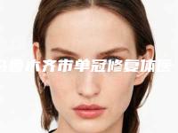 乌鲁木齐市单冠修复体医院上榜清单上榜理由重点介绍(乌鲁木齐市单冠修复体口腔医院实力_价格想了解戳进来看)