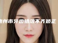 惠州市牙齿错落不齐矫正价格价位表C位出道-惠州市牙齿错落不齐矫正价格