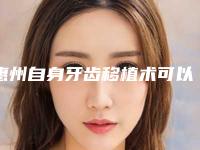 惠州自身牙齿移植术可以期维持多久时间
