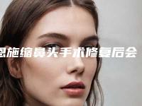 恩施缩鼻头手术修复后会出现后遗症吗(恩施缩鼻头手术修复整形术后有后遗症吗)