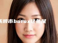 抚顺市botox祛鱼尾纹价格(价目)价位一览(botox祛鱼尾纹均价为:5721元)