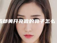 成都黄开亮做的鼻子怎么样?靠谱吗?真实案例来袭~