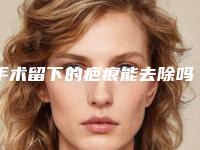 手术留下的疤痕能去除吗?