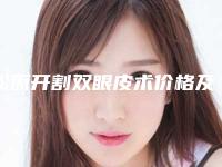 松原开割双眼皮术价格及过程解析