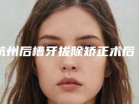 杭州后槽牙拔除矫正术后护理事项
