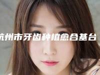 杭州市牙齿种植愈合基台医院上榜名单TOP10强榜出炉（杭州市牙齿种植愈合基台口腔医院优质的选择）